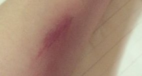 怎么用笔画出逼真伤疤