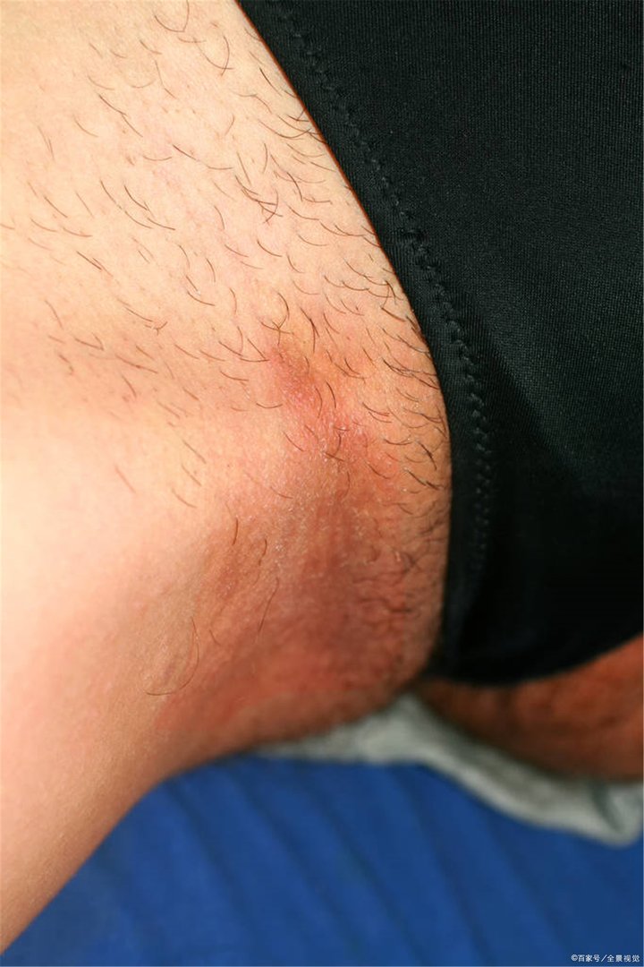 股藓会自己好么！！！