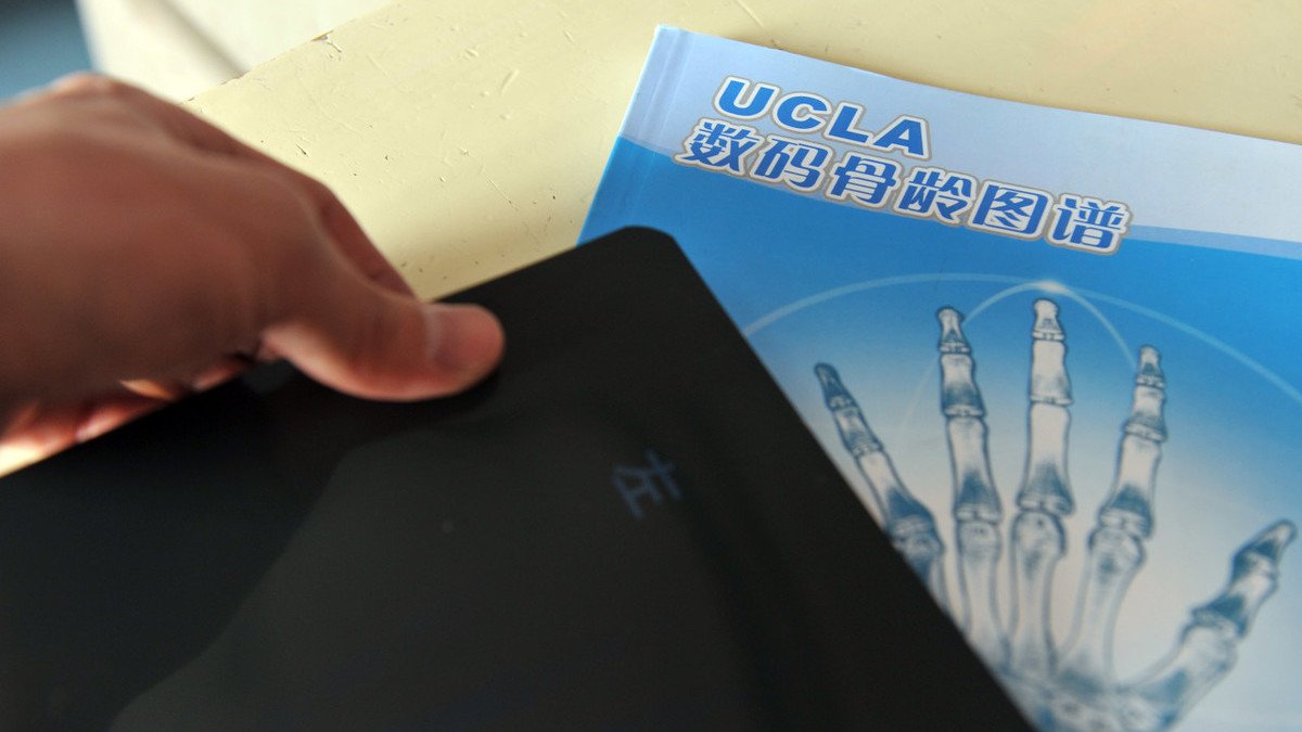 为什么要给孩子测骨龄？什么时候测最好？