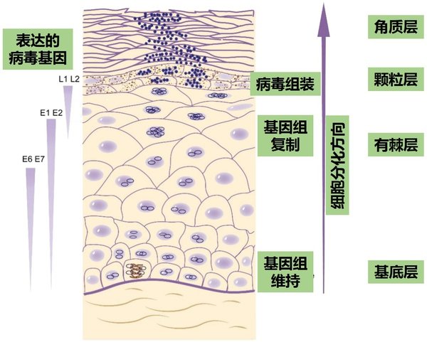 为什么脸上会长扁皮尤呢？扁皮尤又是怎样形成的呢？