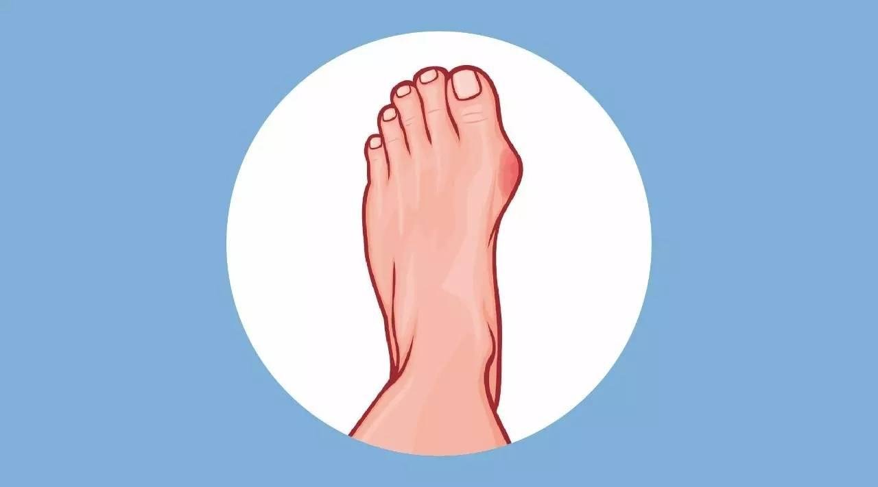 大脚趾头有点麻木是怎么回事