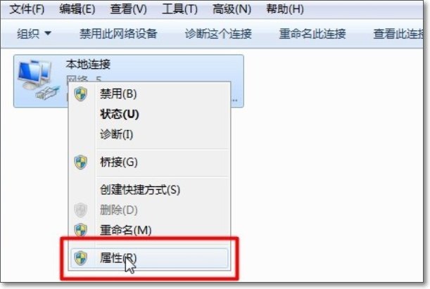 如何更改本机IP地址 （看详细）