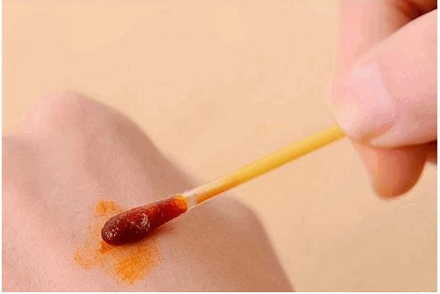 碘酒的作用原理