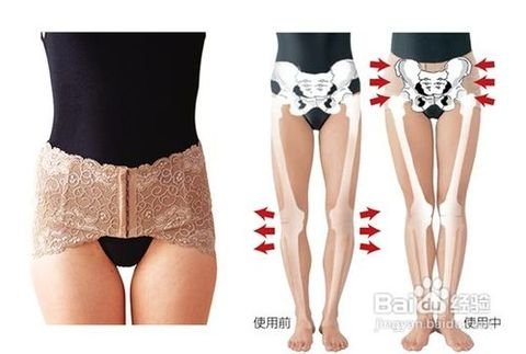 束腹带什么时候用