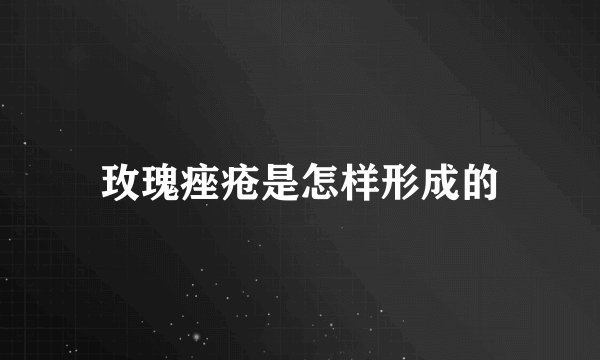 玫瑰痤疮是怎样形成的