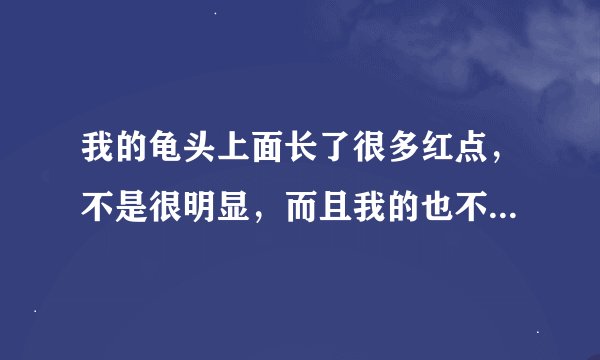我的龟头上面长了很多红点，不是很明显，而且我的也不是包皮，这是怎么回事？