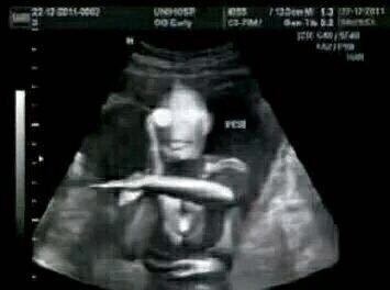 求恶搞奥特曼b超图片，套路别人的