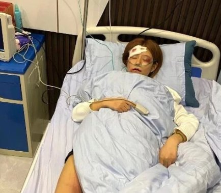 网红王多鱼遭男友家暴入院，女性遭遇家暴该如何维权呢？