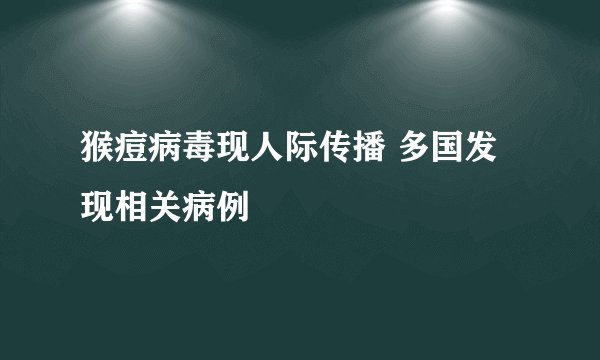 猴痘病毒现人际传播 多国发现相关病例