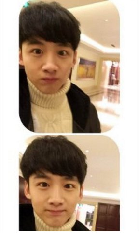 白敬亭整容对比照很明显吗？