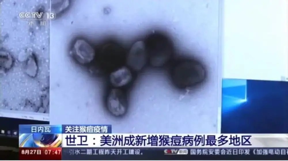 日本国内发现第五例猴痘病毒感染病例,此病毒已经波及到了哪些国家?