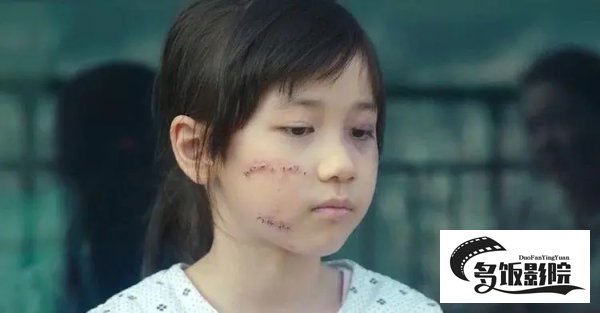 素媛原型脸上的肉被咬下来