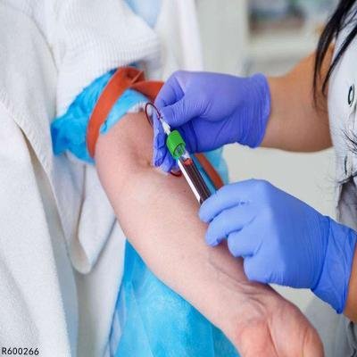 胆红素偏高的原因及治疗方法