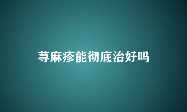 荨麻疹能彻底治好吗