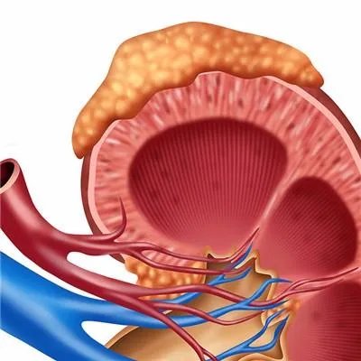 怎么治疗尿毒症
