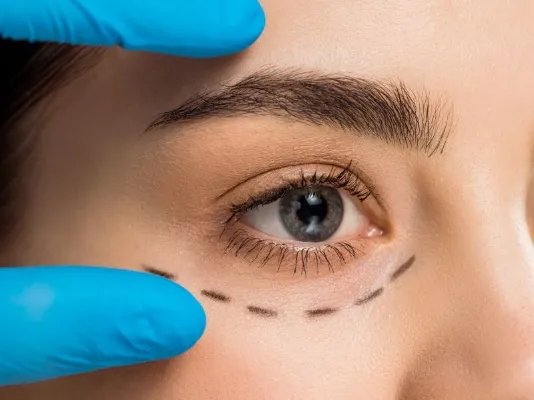 注射填充材料有哪些