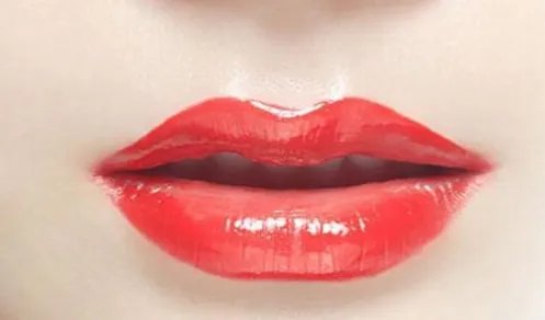 玻尿酸丰唇好不好