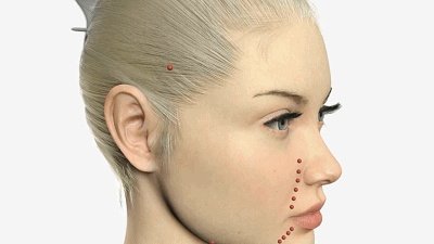 面部除皱最好的方法是什么？