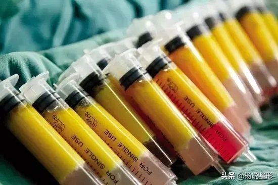 面部除皱最好的方法是什么？