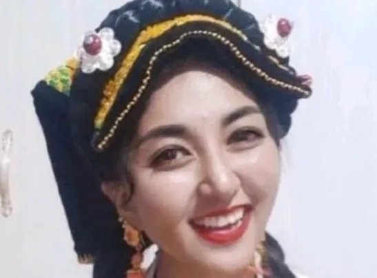 网红拉姆遭前夫纵火焚烧重度烧伤是怎么回事？