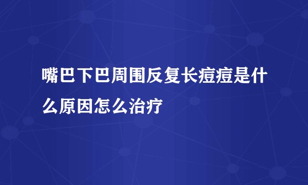 嘴巴下巴周围反复长痘痘是什么原因怎么治疗