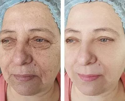 怎么快速消除眼袋 揭秘快速消除眼袋的四个方法