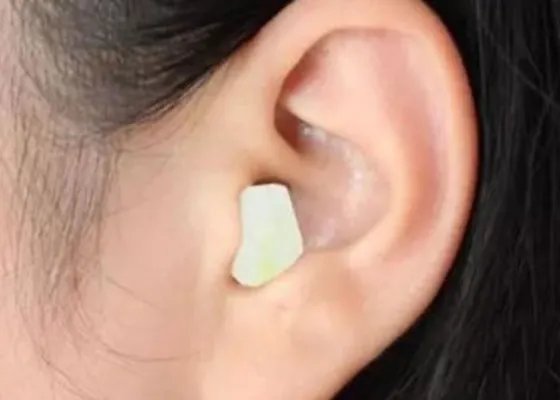 洋葱放入耳朵一夜竟然出现奇迹了（图）