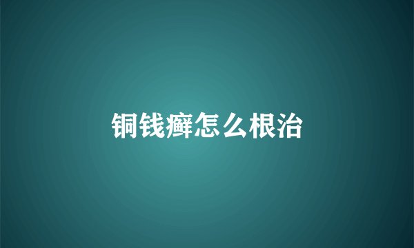 铜钱癣怎么根治