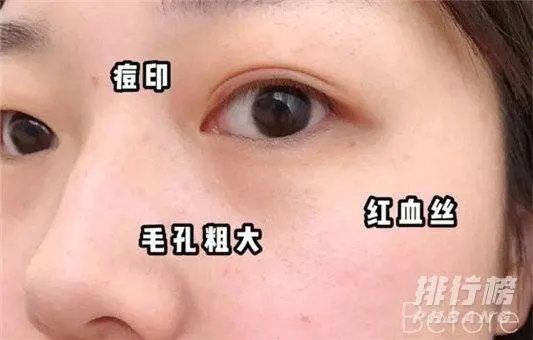 赫莲娜绿宝瓶精华新旧版本对比_赫莲娜绿宝瓶精华新旧版本区别