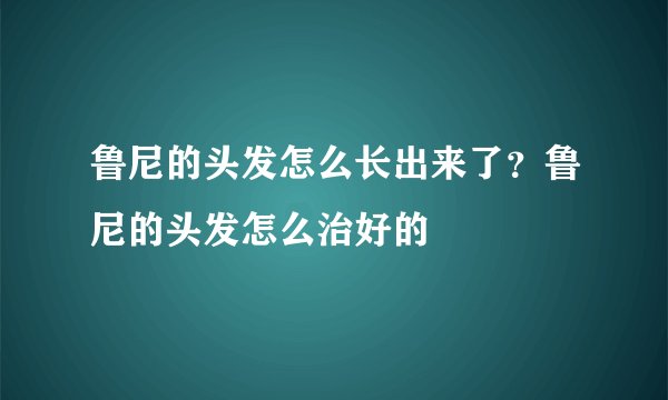 鲁尼的头发怎么长出来了？鲁尼的头发怎么治好的