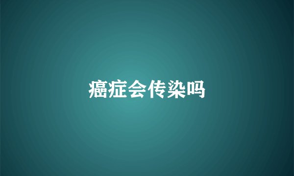 癌症会传染吗