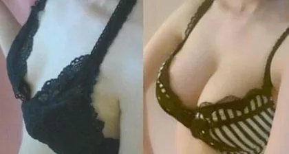 2021云南吴氏嘉美医疗美容医院隆胸价格表(价目表)怎么样?