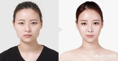 赴韩整容失败,各位怎么看?