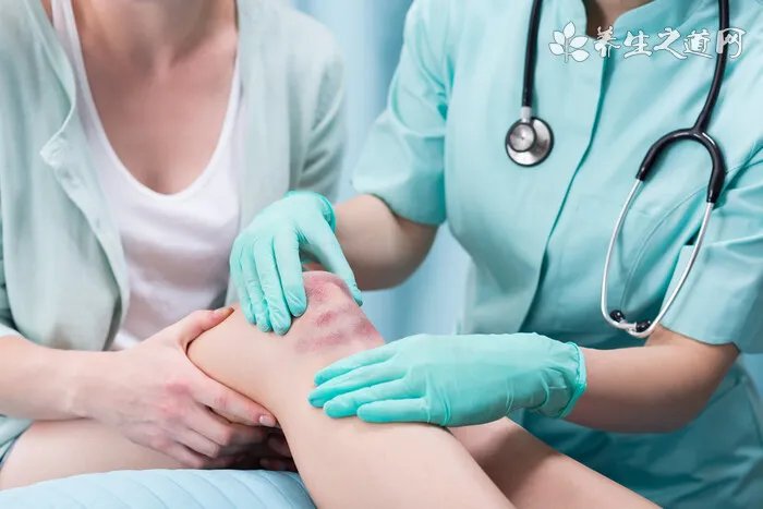 边境牧羊犬好养吗 边境牧羊犬饲养注意事项