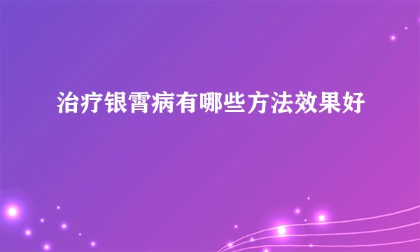 治疗银霄病有哪些方法效果好