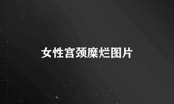 女性宫颈糜烂图片