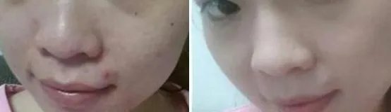 上海疤痕整形手术好不好