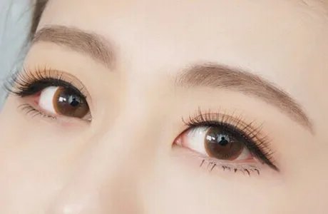 如何去除眼下皱纹