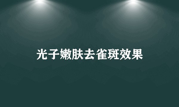 光子嫩肤去雀斑效果