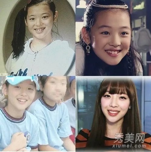 崔雪莉整容了吗