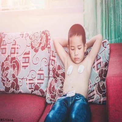 皮肤癣的症状 皮肤癣的治疗