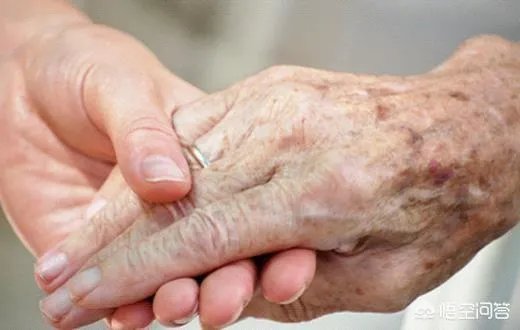 老年斑是怎么回事？