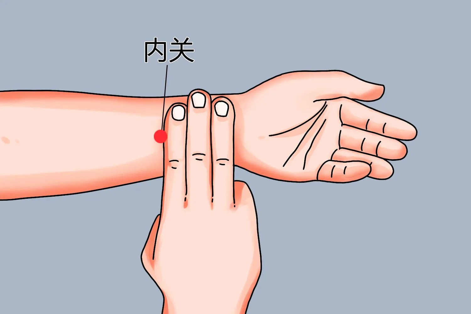 偏瘫的针灸治疗的位置示意图