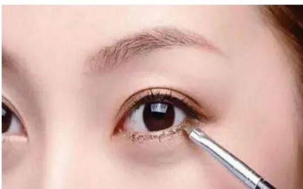 哪种双眼皮最好