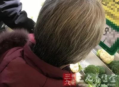 男女身上有这根毛当心活不长