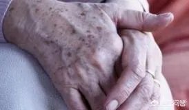 老年斑是怎么回事？