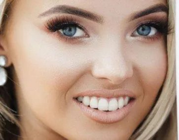 玻尿酸注射的价格