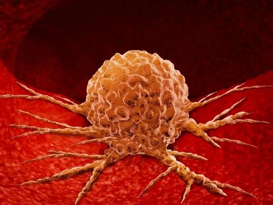 有这5个习惯危害可不小，易被癌症“盯上”，若你有尽早改掉