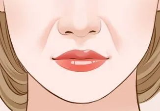 鼻唇沟填充术是什么呢？