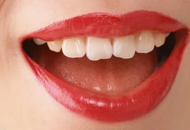 满口牙种植多少钱